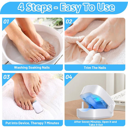 Rechargeable Nail Fungus Laser ? Anti-Fungal Device Toenails, Hands & Feet (Home Use)