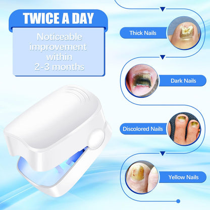 Rechargeable Nail Fungus Laser ? Anti-Fungal Device Toenails, Hands & Feet (Home Use)